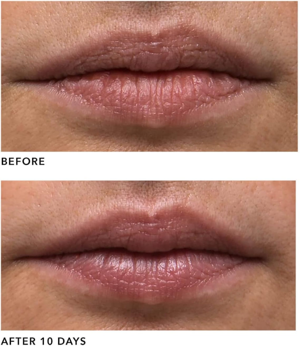 Algenist GENIUS Liquid Collagen Lip 0.5 oz