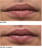 Algenist GENIUS Liquid Collagen Lip 0.5 oz