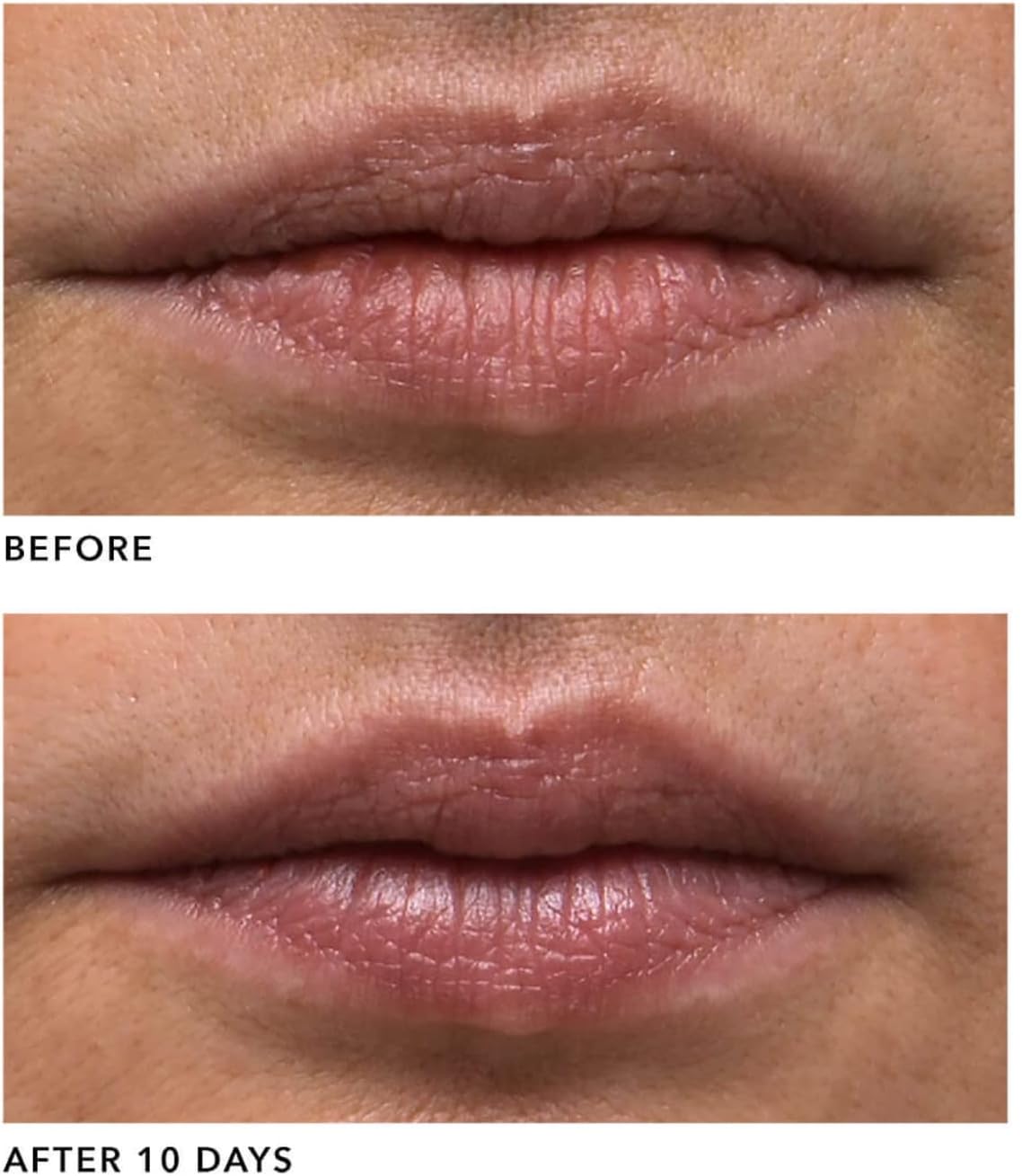 Algenist GENIUS Liquid Collagen Lip 0.5 oz