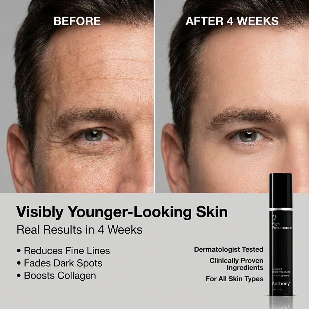 Anthony High Performance Vitamin A Treatment